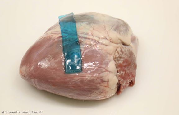 A hydrogel tough adhesive bonded to a heart © Dr Jianyu Li/ Harvard University. Natural History Museum
